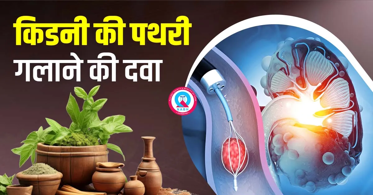 किडनी-की-पथरी-गलाने-की-दवा